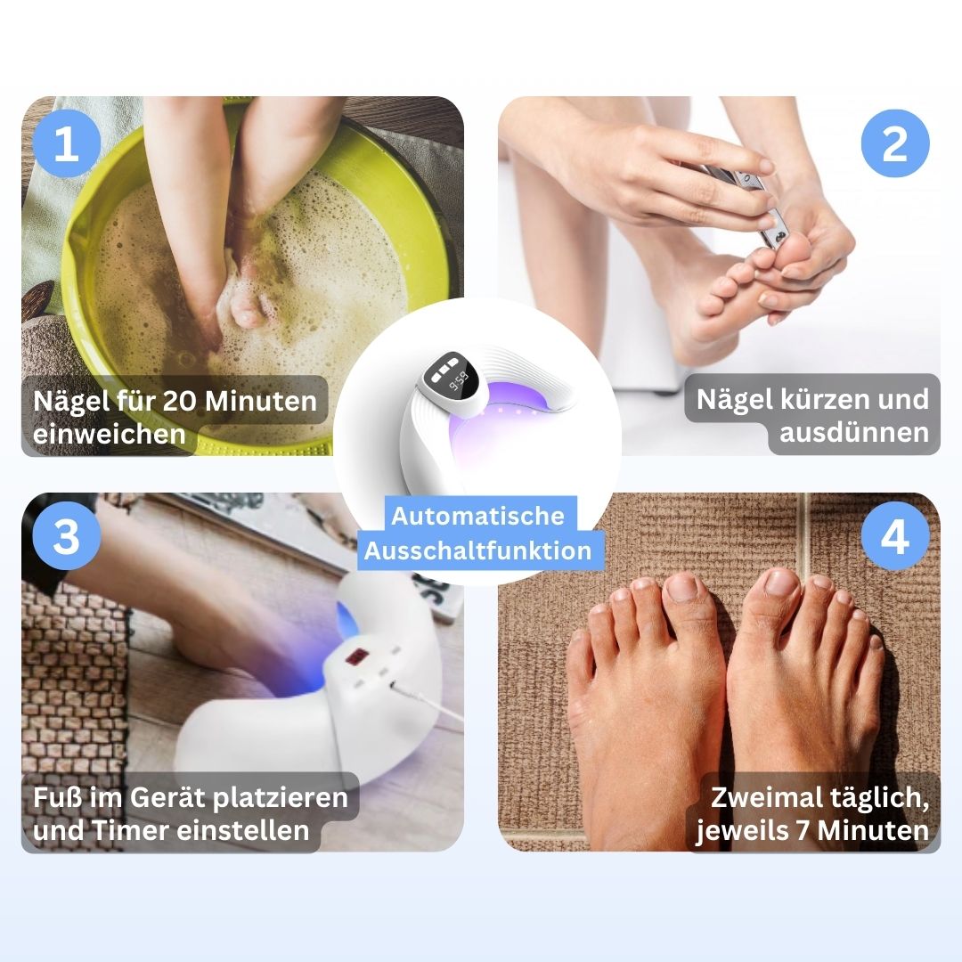 MykoCare Lichttherapie – Pijnloze Behandeling tegen Nagelschimmel zonder Chemie